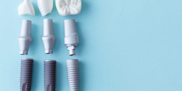 Zahnimplantate aus Keramik und Titan